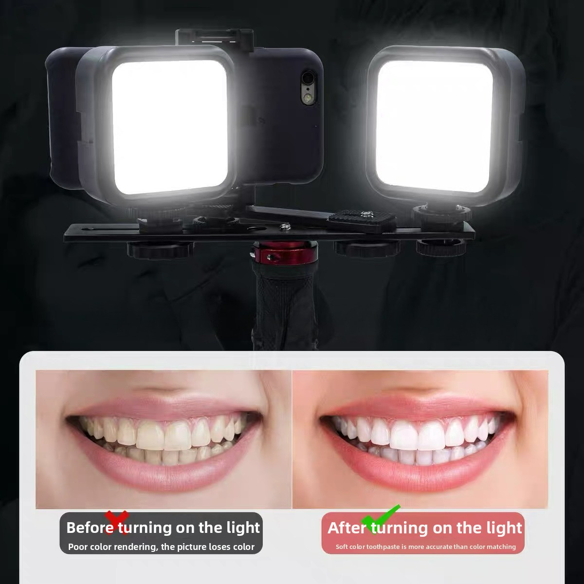 Photography Lighting Basics - Dental Photography Light with Bluetooth Oral
